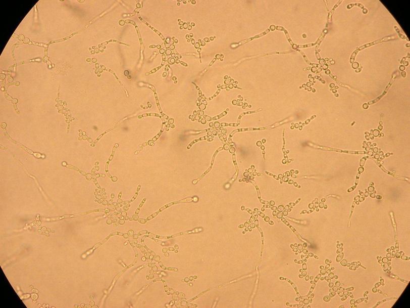 br. 2. Candida albicans, mikroskopický obraz Zdroj obrázků Leading international fungal education - http://www.life-worldwide.org/fungaldiseases/candida-albicans 2.5.2. Candida tropicalis Buňky jsou kulovité nebo mírně oválné, mezi nimi jsou i buňky cylindrické a protáhnuté.