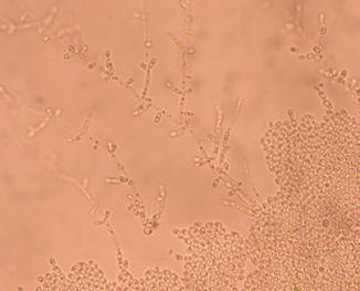 br. 4. Candida tropicalis, mikroskopický obraz Zdroj obrázků Leading international fungal education - http://www.life-worldwide.org/fungaldiseases/candida-tropicalis1 2.5.3.