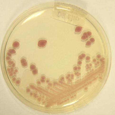 Blastospory jsou elipsoidního až válcovitého tvaru. Snadno vytváří pseudomycelium s protáhlými konidiemi. Kolonie jsou matné a zploštělé, v barvě šedo-béžové. Charakteristicky voní po acetonu.