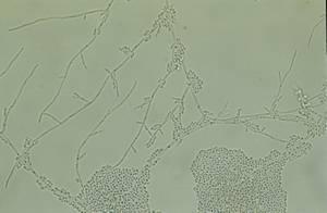 br. 6. Candida krusei, mikroskopický obraz Zdroj obrázků Leading international fungal education - http://www.life-worldwide.org/fungaldiseases/candida-krusei 2.5.4.