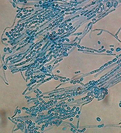 br. 10. Trichosporon asahii, mikroskopický obraz Zdroj obrázků Mycology online - http://www.mycology.adelaide.edu.au/virtual/2008/id2-apr08.html 2.5.6.