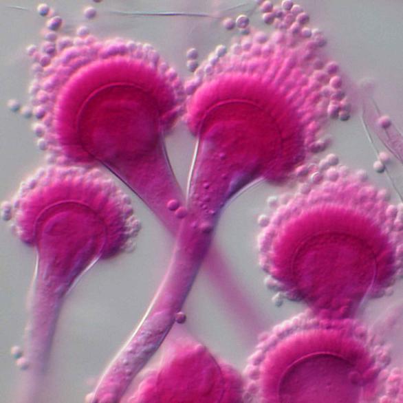 br. 12. Aspergillus fumigatus, mikroskopický obraz Zdroj obrázků Fungi myspecies - http://fungi.myspecies.info/all-fungi/aspergillus-fumigatus 2.5.7.