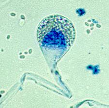 br. 14. Absidia corymbifera, mikroskopický obraz Zdroj obrázku Mycology online - http://www.mycology.adelaide.edu.au/fungal_descriptions/zygomycetes/lichtheimia%20(absidia)/ 2.5.8.