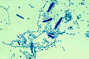 br. 16. Trichophyton mentagrophytes, mikroskopický obraz Zdroj Mycology online - http://www.