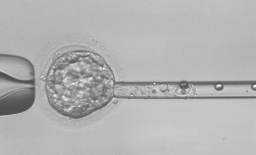 Obrázek 4 - Biopsie buněk trofektodermu z blastocysty (z archivu Genetické laboratoře Sanatoria PRONATAL) 2.3.