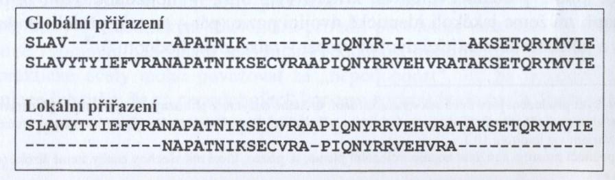 Analytické nástroje porovnávání dvou sekvencí Globální vs.