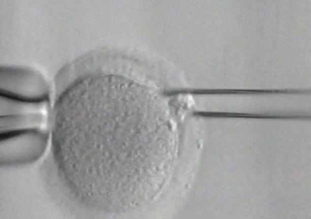 vyšetření polárních tělísek je tedy testována pouze mateřská chromosomová výbava budoucího embrya, viz Obr. č. 1. u zralého vajíčka 1.