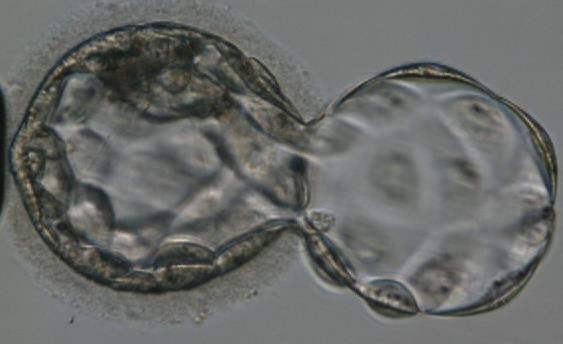 3) Trofoektoderm Odběr se provádí 5. - 6. den vývoje embrya (blastocysty), kdy se šetrně odebere několik buněk trofoektodermu.