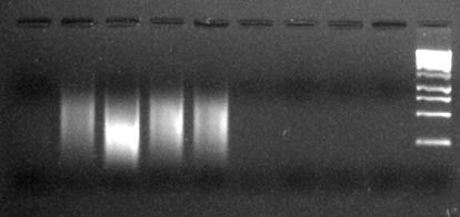 4.5.1.2 Kontrola úspěšnosti amplifikace pomocí gelové elektroforézy Veškerá manipulace s naamplifikovanými vzorky probíhá v Post PCR laboratoři.