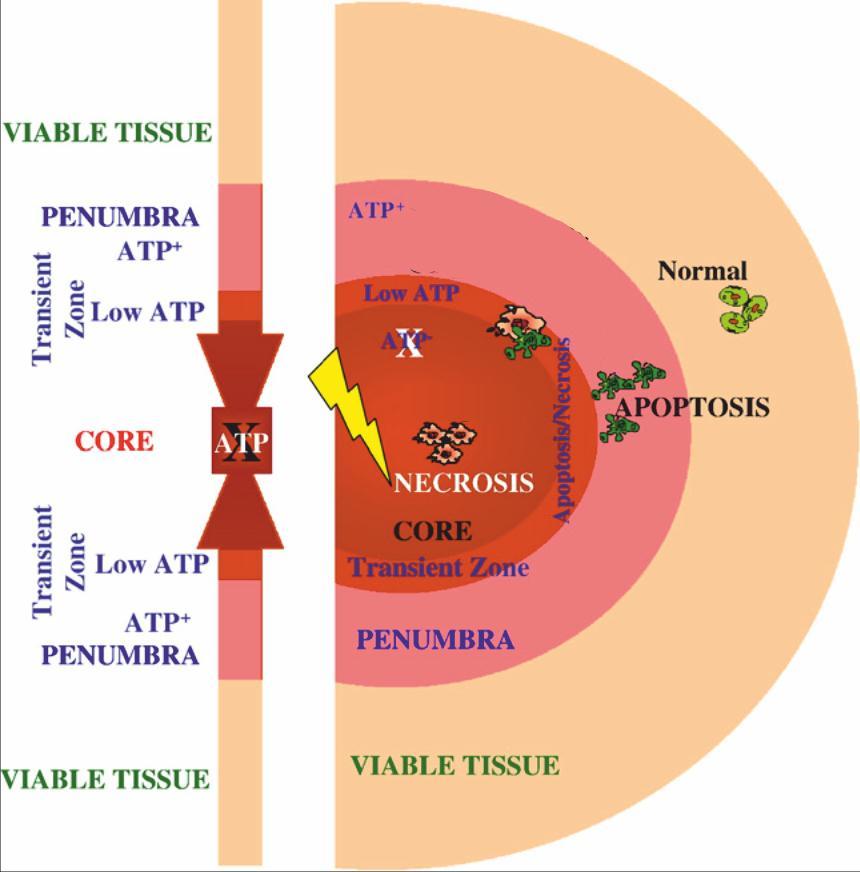 M a r t i n V a l n ý 32 are included into the infarct core, whereas cells in distal part of penumbra are spared from cell death and exhibit only scattered injury (Fig.