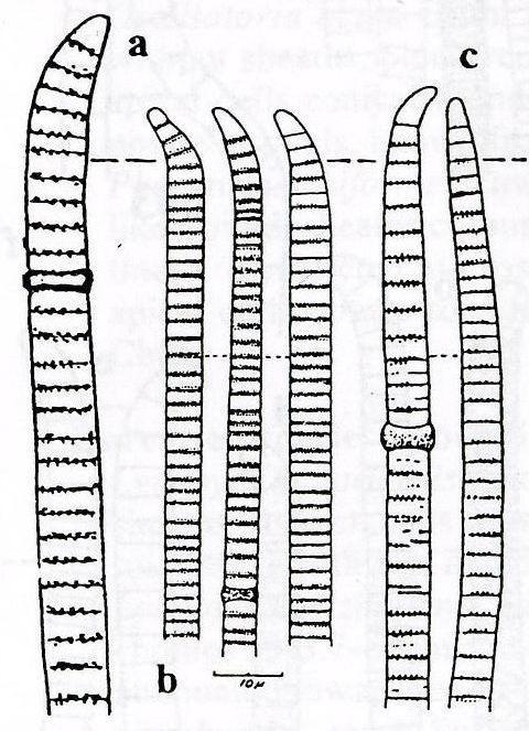 VI. VII. VIII. Vlákna směrem ke konci krátce zúţená vrcholové buňky kulovité. Vlákna krátce ĉi postupně zúţená, vrcholové buňky (dobře vyvinuté) s kalyptrami.