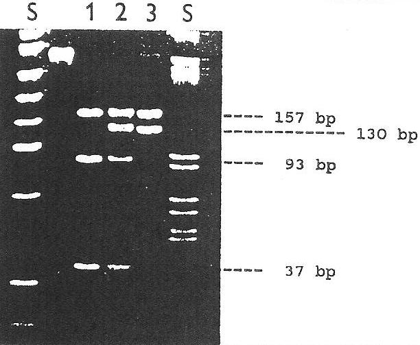 Obr. 17: Elektroforéze DNA F V na akrylamidovém gelu (restrikční endonukleáza Mnl I) 1 normální F V (G/G), 2 heterozygotní F V Leiden (G/A), 3 homozygotní F V Leiden (A/A), S standard DNA (Hudeček et