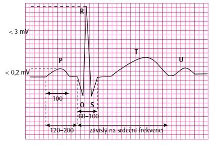 6.2 Identifikace významných znaků Pro možnost správného vyhodnocení EKG záznamu je nutností přesná identifikace fyziologicky důležitých znaků.