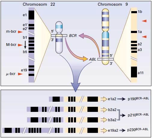 Za Ph + chromosom povaţujeme zkrácený chromosom 22, který je výsledkem reciproké translokace t(9;22)-(q34;q11) mezi dlouhými raménky chromosomu 22 a 9.