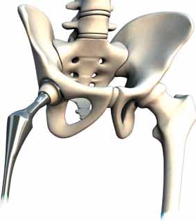 133). 2. Xarelto SPC. 3. Eriksson, J Bone Joint Surg [Br] 2009;91-B:636-44.