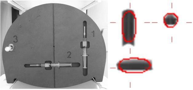 Obr. 33: Vlevo: molitanový fantom + sada stříkaček pro hodnocení prostorové registrace SPECT/CT. Vpravo: fúze CT (podklad ve stupních šedi) + SPECT (červeně vyznačené kontury dle nastaveného prahu).
