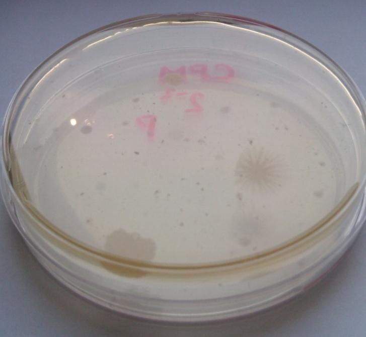 log KTJ/g 5.1 Celkový počet mikroorganismů CPM poskytuje základní informace o stupni mikrobiální kontaminace.