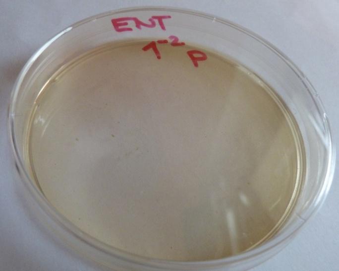 log KTJ/g Obrázek 12 - Petriho miska s půdou COMPASS Enterococcus Agar inkubovaná při 44 C/1 den: enterokoky nejsou přítomny Vývoj počtu enterokoků v