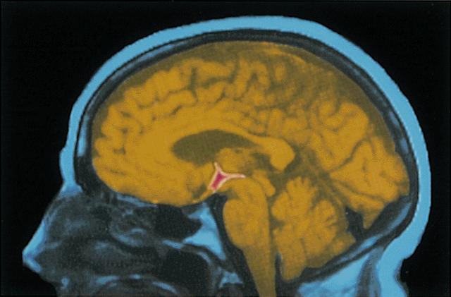 Motivation - Hunger The hypothalamus