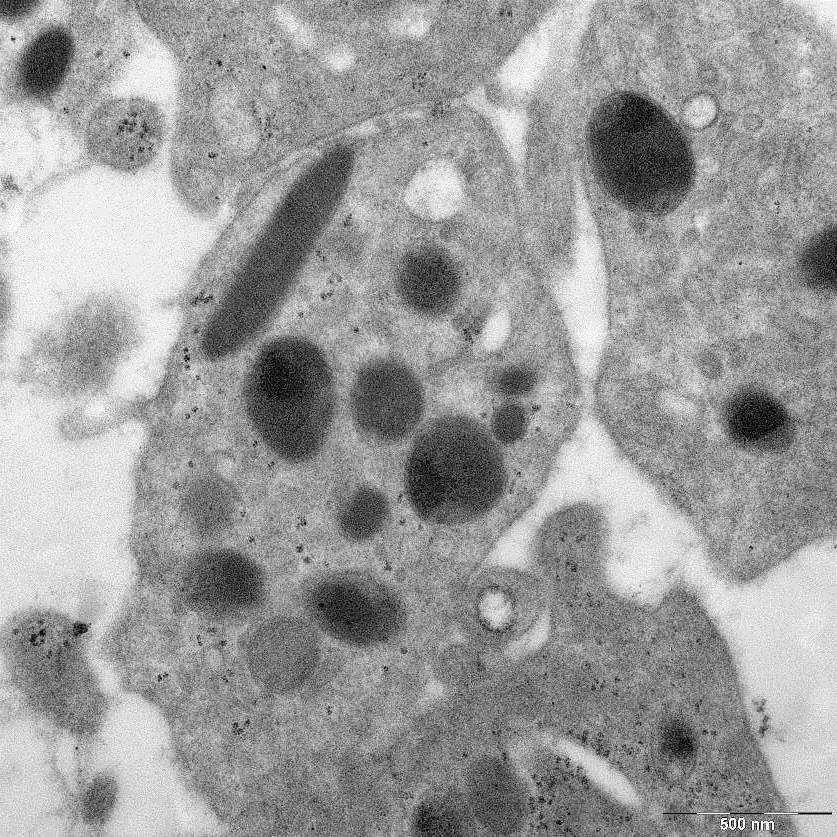 pseudopodie velikost: 2 4 m hyalomera světle modrá