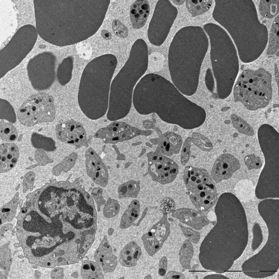 4 μm (normocyt) struktura: plazmalema cytoplazma +