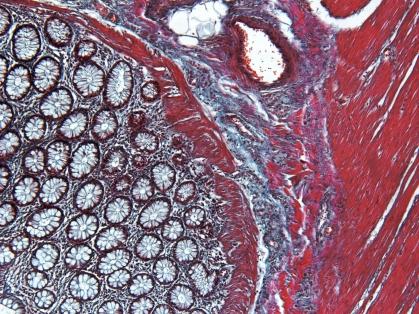 Kyselé - eosin Modrá, ﬁalová (hematoxylin) Jádro Ribozómy Růžová (eosin) Cytoplasma