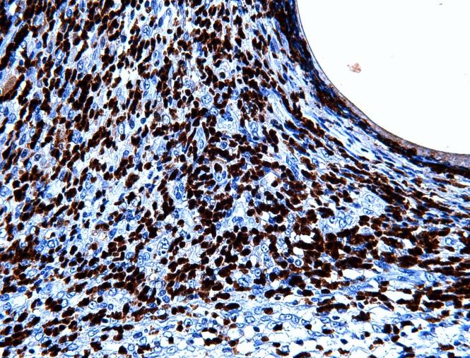 Imunohistochemie Imunohistochemie je metoda, která je založena na reakci pro látek (imunoglobulinů) se speciﬁckými an geny bílkovinné povahy.