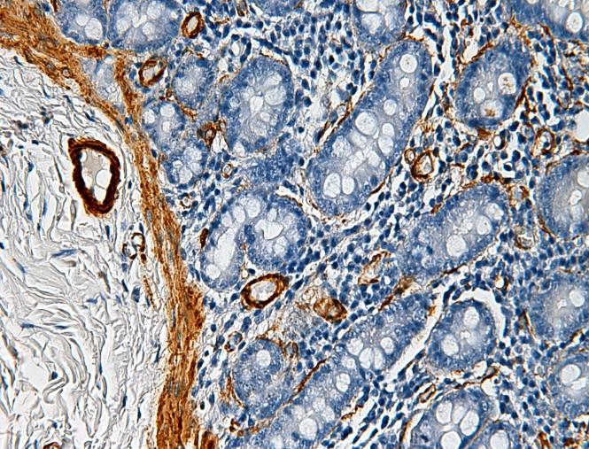 V současnos je imunohistochemie velmi rozšířenou metodou, která má své místo nejen ve výzkumu, ale také v ru nní histopatologické praxi.