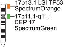 FIRMA ABBOTT MOLECULAR LSI TP53 / CEP 17 Obrázek č. 19: Ideogram chromozómu 17 a vizualizace oblastí, na které se váže sonda LSI TP53 / CEP 17 (Abbott Molecular, 2014 - www.abbottmolecular.com).