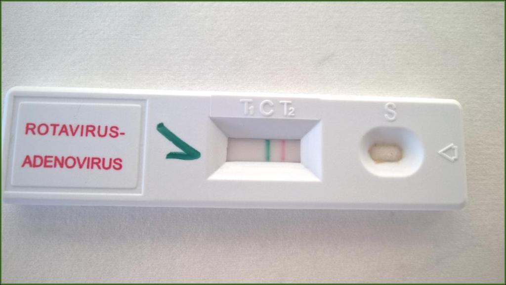 Norovirus - antigen Norovirus - antigen stolice cca 1 cm