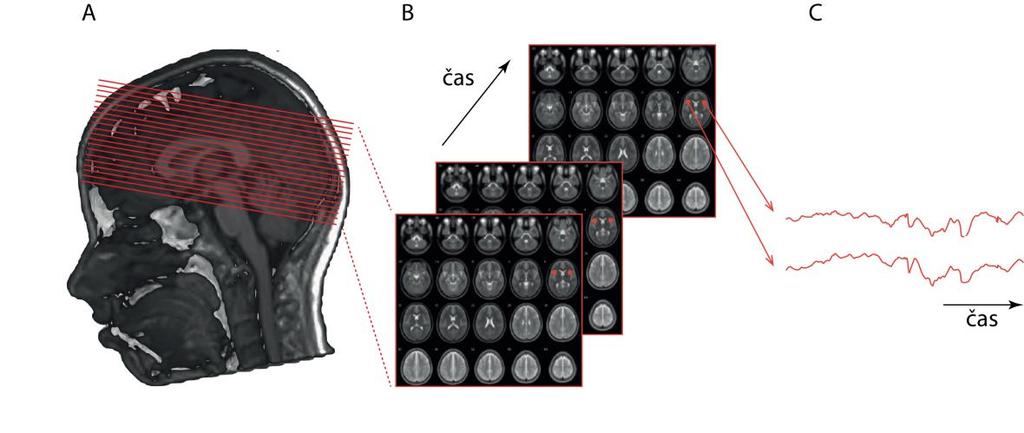 Obrázek 4: Ukázka MRI dat. T1 