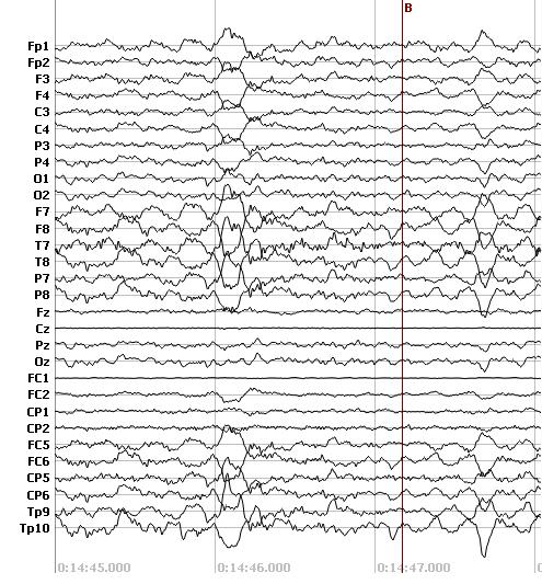 Na obrázku 6 je pro představu znázorněn krátký úsek měřeného EEG.