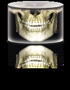 Planmeca ProMax 3D Plus Kvalita snímků přístroje Planmeca ProMax 3D Plus ohromila specialisty na ústní chirurgii v Německu Dr.