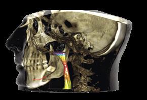 Nejsofistikovanější software pro 3D Náš inovativní software Planmeca Romexis nabízí nástroje speciálně navržené pro implantologii, endodoncii, periodoncii, protetiku, ortodoncii, maxilofaciální
