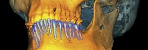 Segmentace zubů Software Planmeca Romexis nabízí intuitivní a zároveň efektivní nástroj pro segmentaci zubů a jejich kořenů z CBCT snímku.