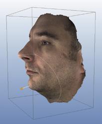 Tvarovací nástroj pro 3D fotografie obličeje Tvarovací nástroj umožňuje libovolné modifikace povrchů zobrazených pomocí Planmeca ProFace tak, aby bylo možné demonstrovat například výsledky ošetření