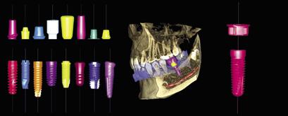 Kompletní pracovní postupy pro implantologii Náš modul Planmeca Romexis 3D Implant Planning