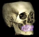 com/uld-poster Analýza dutiny ústní Plánování v implantologii Protokol Planmeca Ultra Low Dose zcela změnil snímkování ve 3D. Prof. Dr.