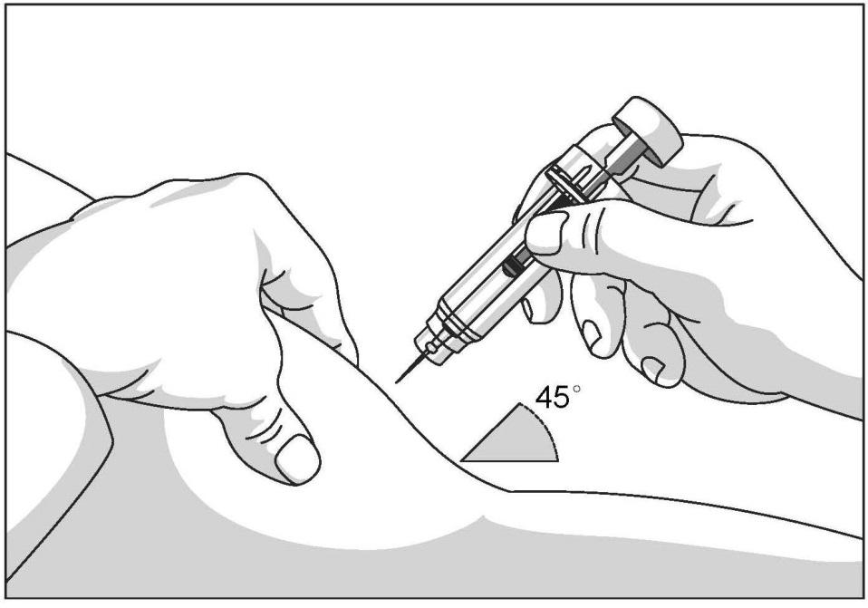 6 Předplněná injekční stříkačka s bezpečnostním krytem jehly h. Jehlu vpíchněte celou do kůže, jak Vám ukázala zdravotní sestra nebo lékař (viz obr. 7). i. Zlehka zatáhněte za píst, abyste se přesvědčil(a), že nebyla nabodnuta céva.