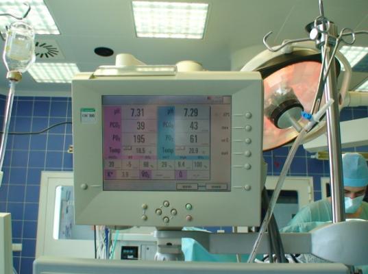 2.4. Monitorovací zařízení a monitorované parametry na MO Průtok krve monitoruje se pomocí průtokových čidel pracujících na principu ultrazvuku nebo přepočítáním otáček čerpadla a průměru vložené