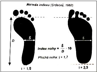 4.4 Metody vyhodnocení Metody důležité pro vyhodnocení byly především dvě, a to metoda BMI indexu a metoda vyhodnocení nožní klenby dle indexu (Srdečný, 1982) (viz obr. 9). Obr.