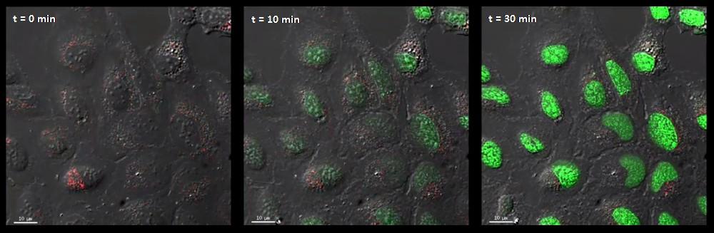 Detekce produkce ROS kitem CellROX Green pod fluorescenčním mikroskopem po vyvolání oxidativního stresu přidáním 100 um menadiónu (buněčná linie U2-OS, Invitrogen).