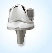 Zimmer fiezací ablony na míru Zimmer pfiedstavuje moïnost implantace totální náhrady kolenního kloubu pomocí individuálních fiezacích ablon PSI (Patient Specific Instruments) Other primary knee