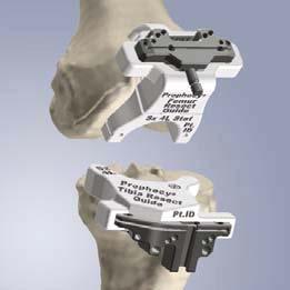 penetration and alignment with obscured anatomic