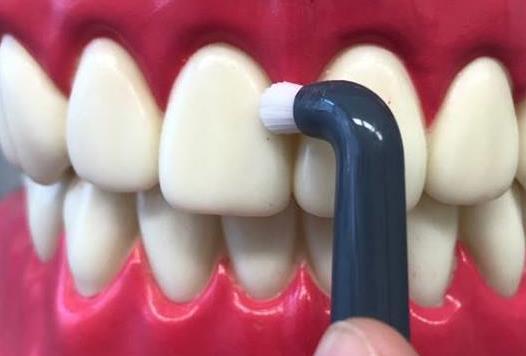 Tato technika čištění je sice časově náročná, ale velice efektivní pro odstraňování zubního plaku (1,7). Pouţití Obrázek 11: Jednosvazkový kartáček.