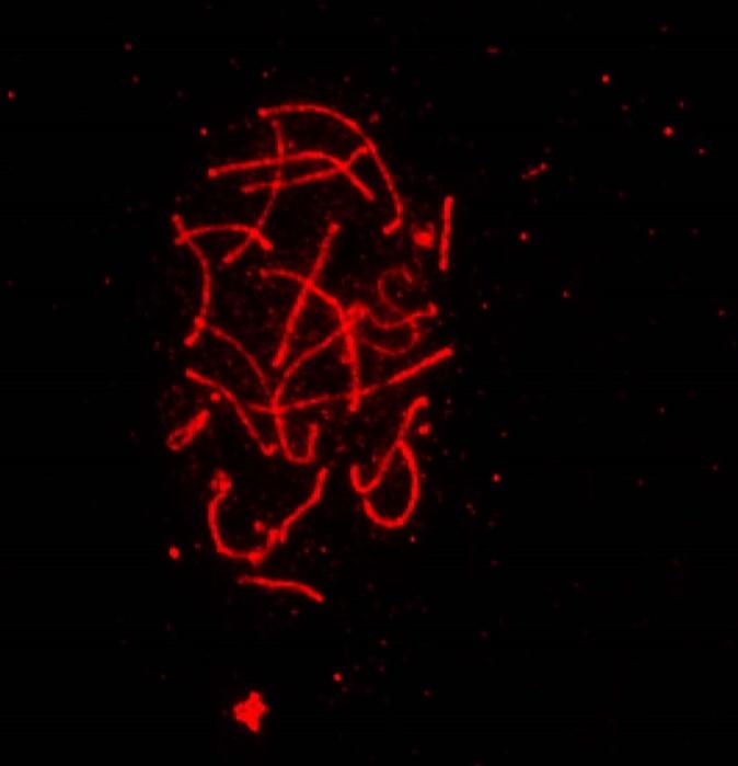 Meiotická inaktivace pohlavních chromosomů