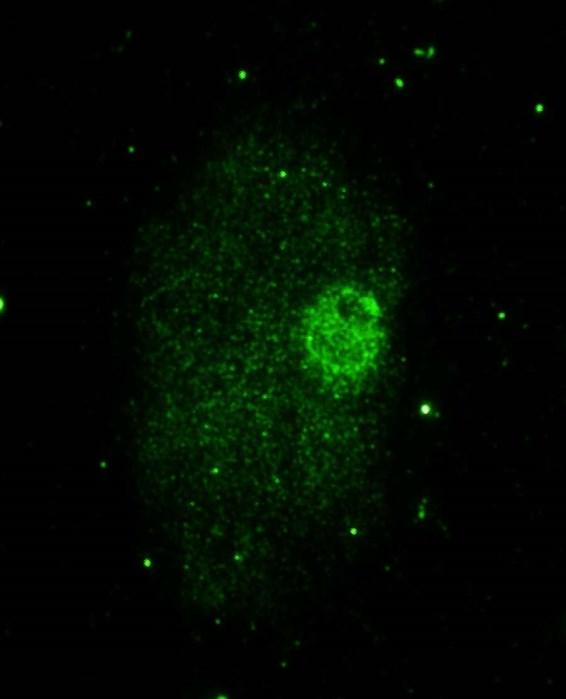 U savců inaktivované pohlavní chromosomy