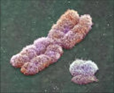 Jaké znaky nás na Y chromozomu zajímají z pohledu genealogie?