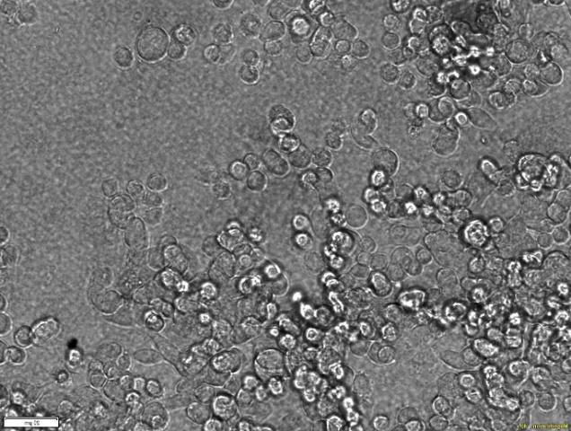 Light microscopy images of LS180 cells,