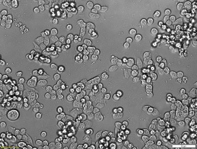 Light microscopy images of LS180 cells, which